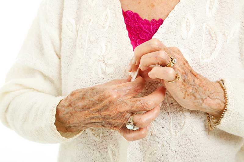 Senior lady buttoning shirt with arthritis